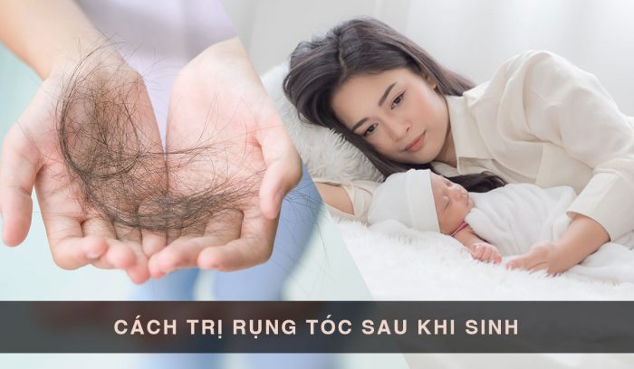 Cách trị rụng tóc sau sinh hiệu quả sau 14 ngày với sản phẩm thiên nhiên