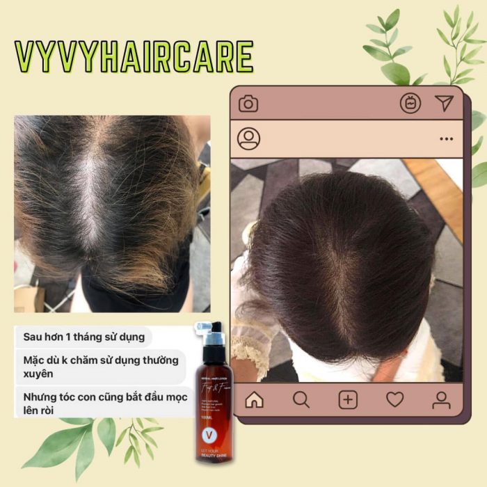 Cách kích thích mọc tóc nhanh từ Xịt bưởi kích mọc của VyvyHairCare